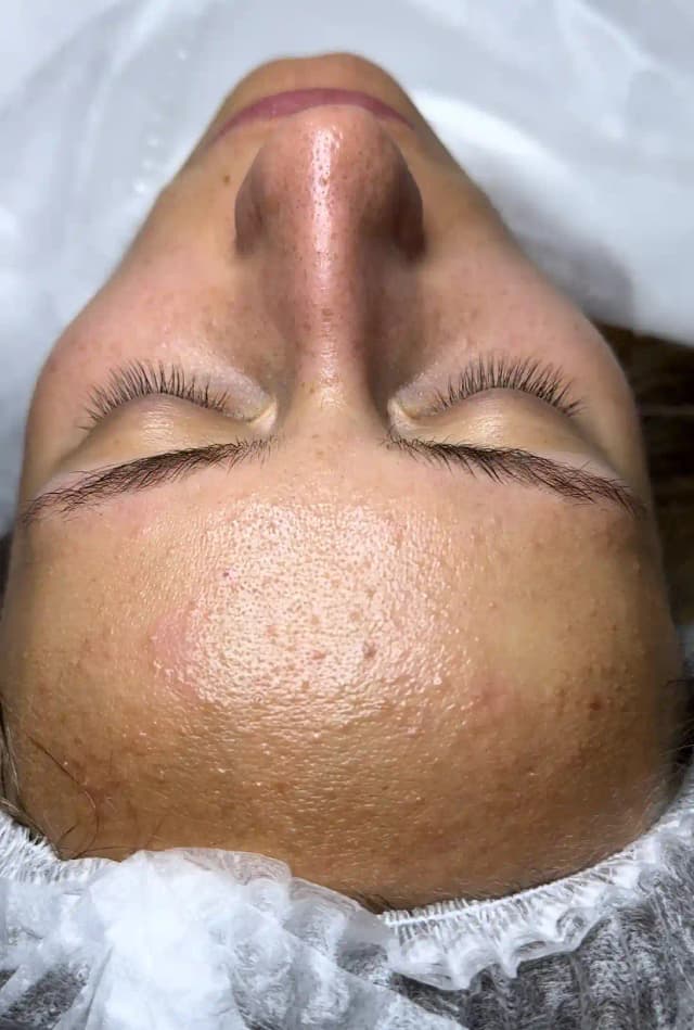 Before image for 3.name