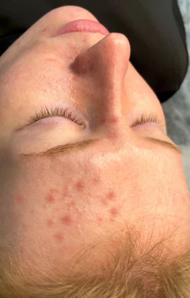 Before image for 4.name