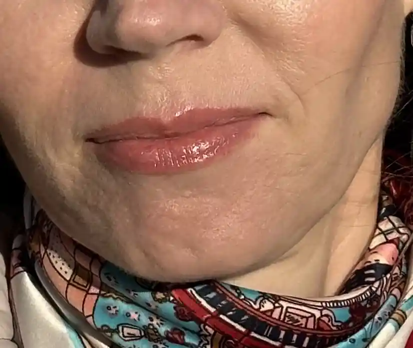 After image for 5.name